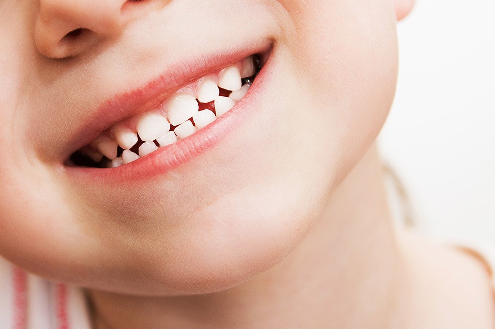 Understanding and Addressing the Challenge of Bruxism (Teeth Grinding) in Children