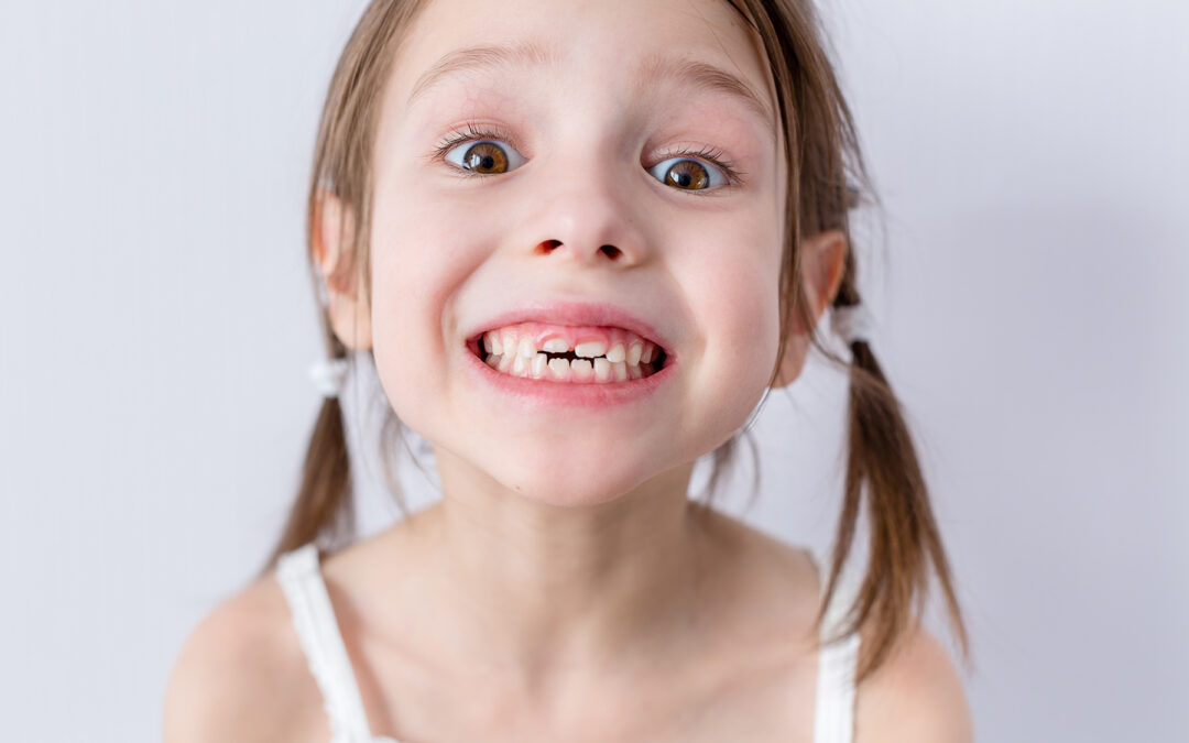 Understanding the Importance of Primary Teeth (Baby Teeth)